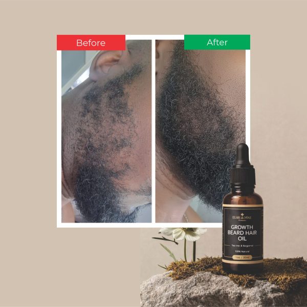 whipped body butter (shea calm eczema relief)